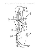 CONNECTING ELEMENT FOR ORTHOPEDIC COMPONENTS diagram and image