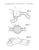 FERTILITY REGULATOR INCORPORATING VAS DEFERENS IMPLANTED OPEN/CLOSE BYPASS IN COMBINATION WITH A HAND HELD CONTROLLER FOR WIRELESS POWER TRANSFER diagram and image