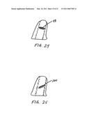 NASAL DEVICES FOR USE WHILE SLEEPING diagram and image