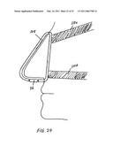 NASAL DEVICES FOR USE WHILE SLEEPING diagram and image