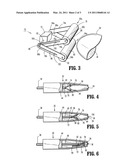 STAPLER POWERED AUXILIARY DEVICE diagram and image