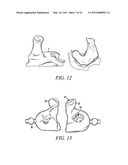 Custom Injection Mold and Molding Process Using Rapid Prototyping Processes diagram and image