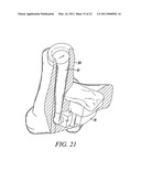 Custom Injection Mold and Molding Process Using Rapid Prototyping Processes diagram and image