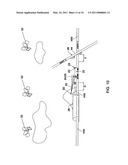 Drag Reducing System diagram and image