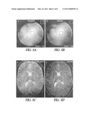 Method for Magnetic Resonance Imaging diagram and image