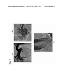 CATHETER RF ABLATION USING SEGMENTATION-BASED 2D-3D REGISTRATION diagram and image