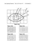 Two Stage Detection For Photographic Eye Artifacts diagram and image