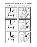 MEDICAL IMAGE PROCESSING DEVICE, MEDICAL IMAGE PROCESSING METHOD, AND MEDICAL IMAGE PROCESSING PROGRAM diagram and image