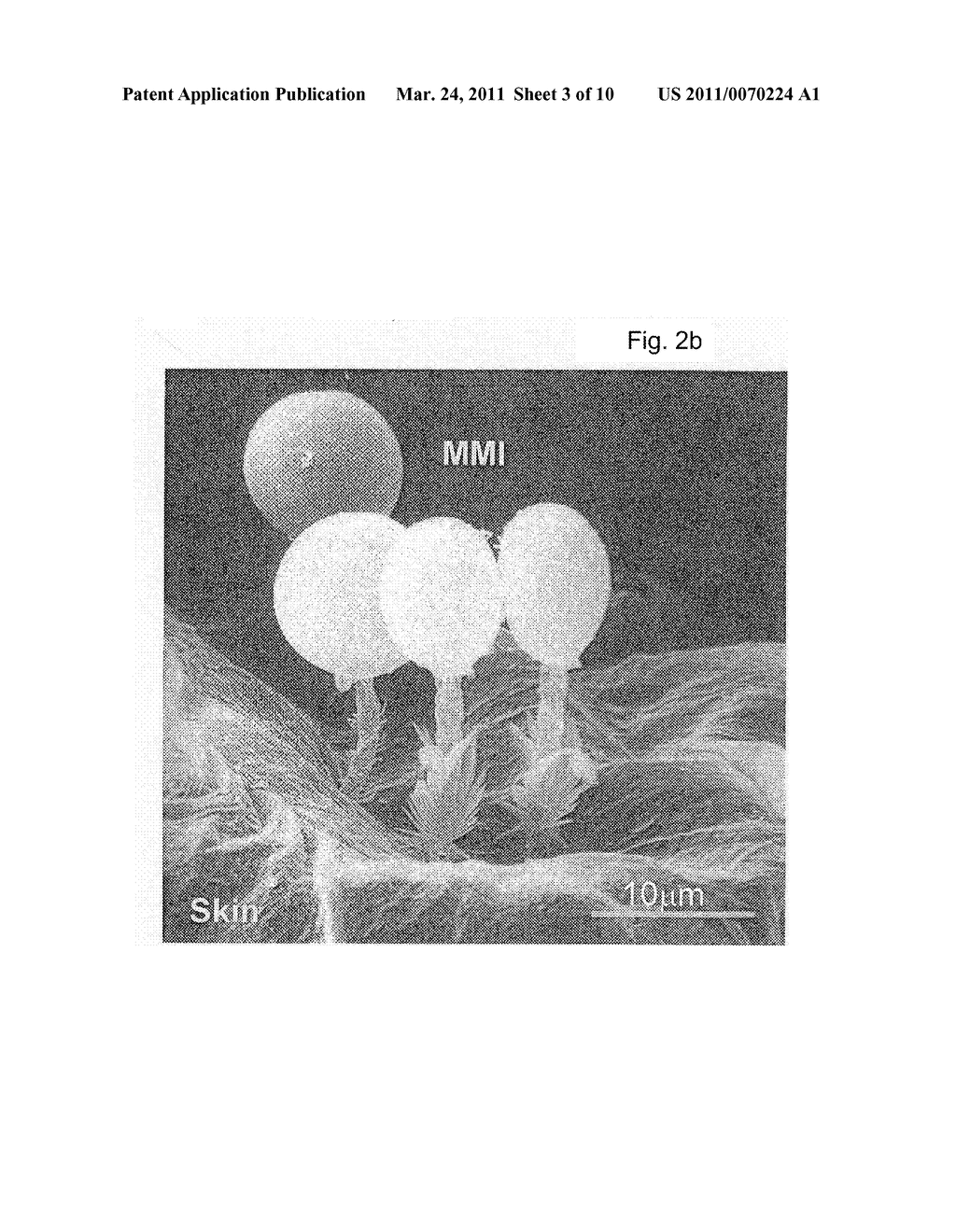 METHODS COMPOSITIONS AND DEVICES UTILIZING STINGING CELLS/CAPSULES FOR DELIVERING A THERAPEUTIC OR A COSMETIC AGENT INTO A TISSUE - diagram, schematic, and image 04