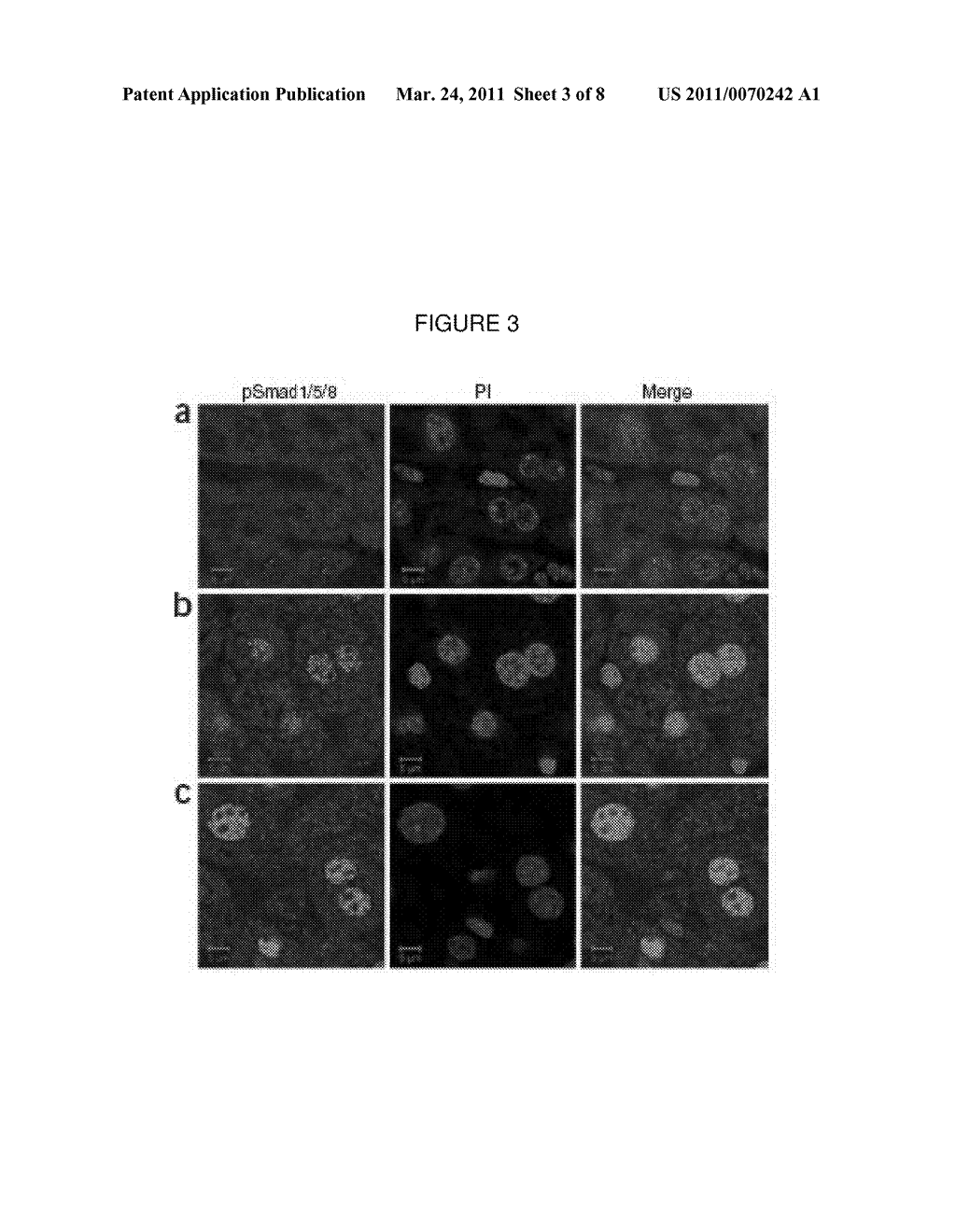 Methods for Diagnosing and Treating Iron Dysregulation - diagram, schematic, and image 04