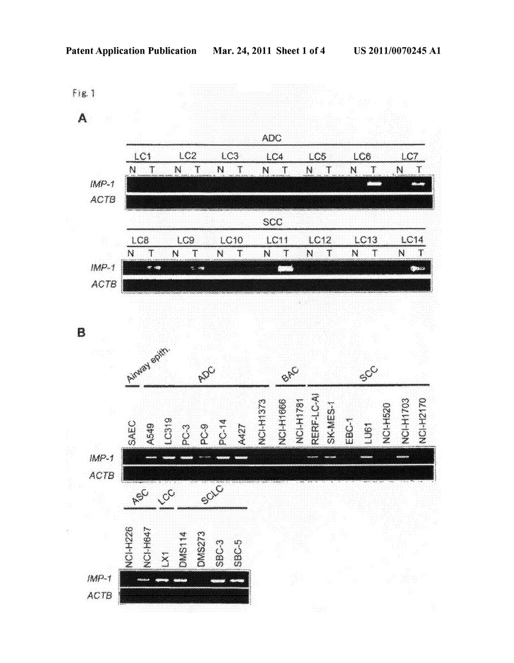 IMP-1 ONCOGENE AS A THERAPEUTIC TARGET AND PROGNOSTIC INDICATOR FOR LUNG CANCER - diagram, schematic, and image 02