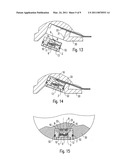 Light Source for a Dental Device diagram and image