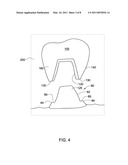 METHOD AND SYSTEM FOR PROVIDING FEEDBACK DATA USEFUL IN PROSTHODONTIC PROCEDURES ASSOCIATED WITH THE INTRA ORAL CAVITY diagram and image