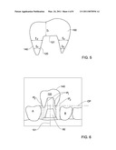 METHOD AND SYSTEM FOR PROVIDING FEEDBACK DATA USEFUL IN PROSTHODONTIC PROCEDURES ASSOCIATED WITH THE INTRA ORAL CAVITY diagram and image