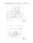 METHOD AND SYSTEM FOR PROVIDING FEEDBACK DATA USEFUL IN PROSTHODONTIC PROCEDURES ASSOCIATED WITH THE INTRA ORAL CAVITY diagram and image