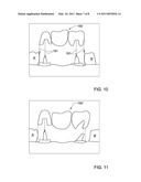 METHOD AND SYSTEM FOR PROVIDING FEEDBACK DATA USEFUL IN PROSTHODONTIC PROCEDURES ASSOCIATED WITH THE INTRA ORAL CAVITY diagram and image