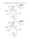 HEART ASSIST DEVICE diagram and image