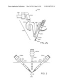 CANNULA MOUNTING FIXTURE diagram and image