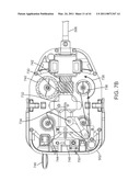 CANNULA MOUNTING FIXTURE diagram and image