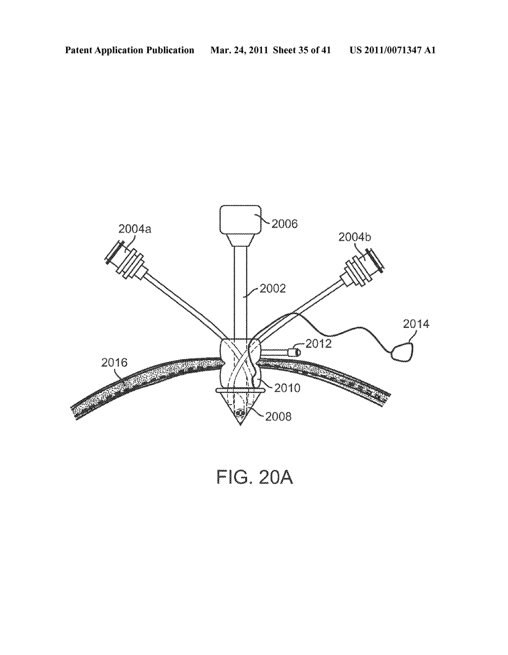 CANNULA MOUNTING FIXTURE - diagram, schematic, and image 36