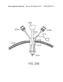 CANNULA MOUNTING FIXTURE diagram and image