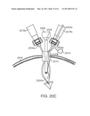 CANNULA MOUNTING FIXTURE diagram and image