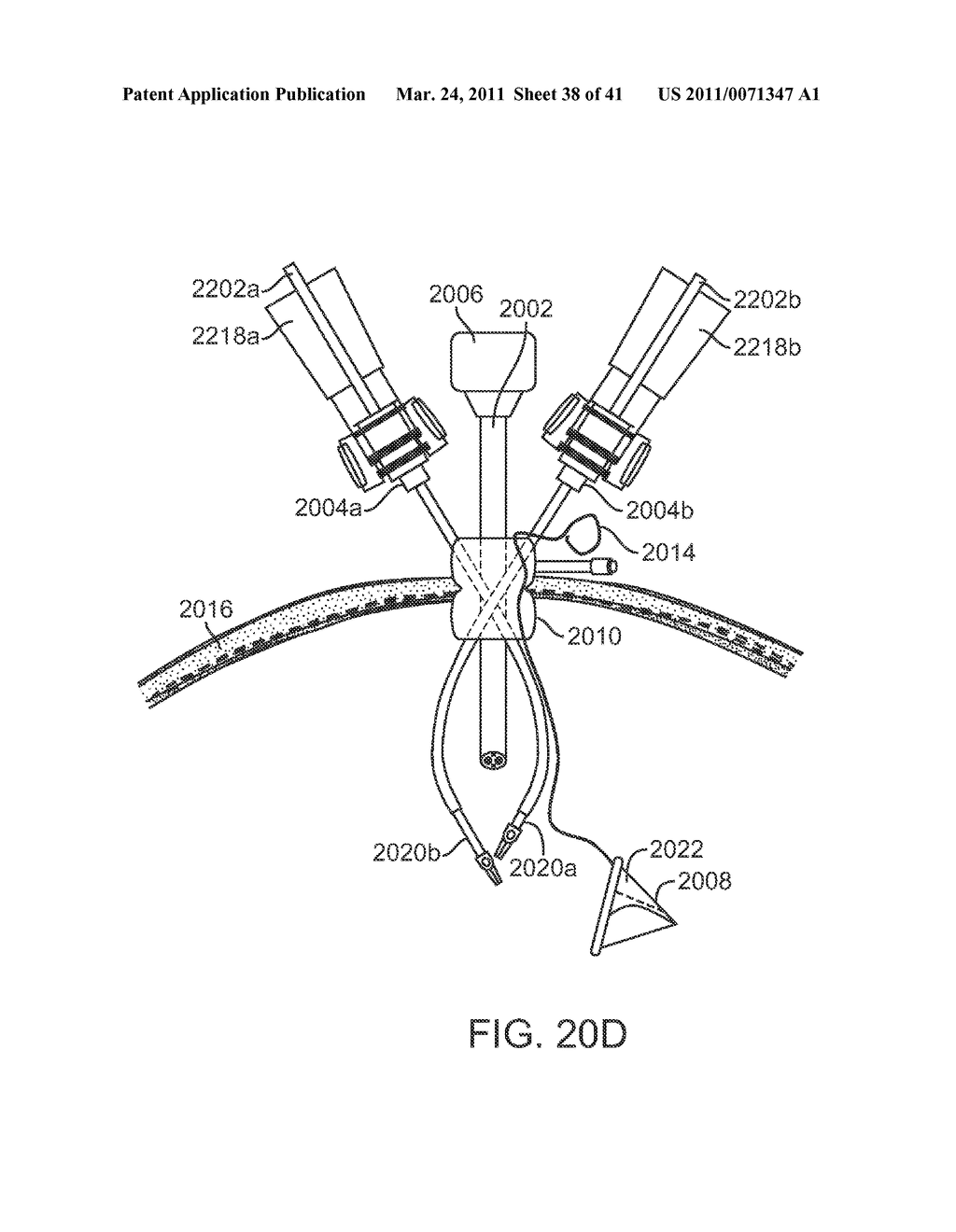 CANNULA MOUNTING FIXTURE - diagram, schematic, and image 39