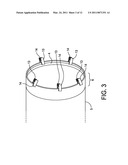 APPARATUS AND METHOD FOR SIMULATION OF DIASTOLE AND VISUALIZING THE DIASTOLIC STATE OF AN AORTIC VALVE AND ROOT DURING CARDIAC SURGERY diagram and image