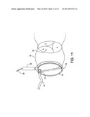 APPARATUS AND METHOD FOR SIMULATION OF DIASTOLE AND VISUALIZING THE DIASTOLIC STATE OF AN AORTIC VALVE AND ROOT DURING CARDIAC SURGERY diagram and image