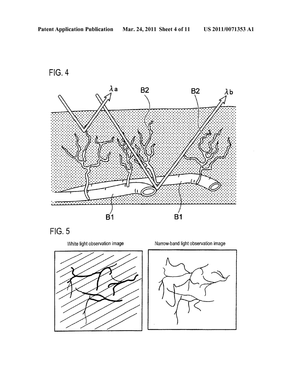 METHOD OF CONTROLLING ENDOSCOPE AND ENDOSCOPE - diagram, schematic, and image 05