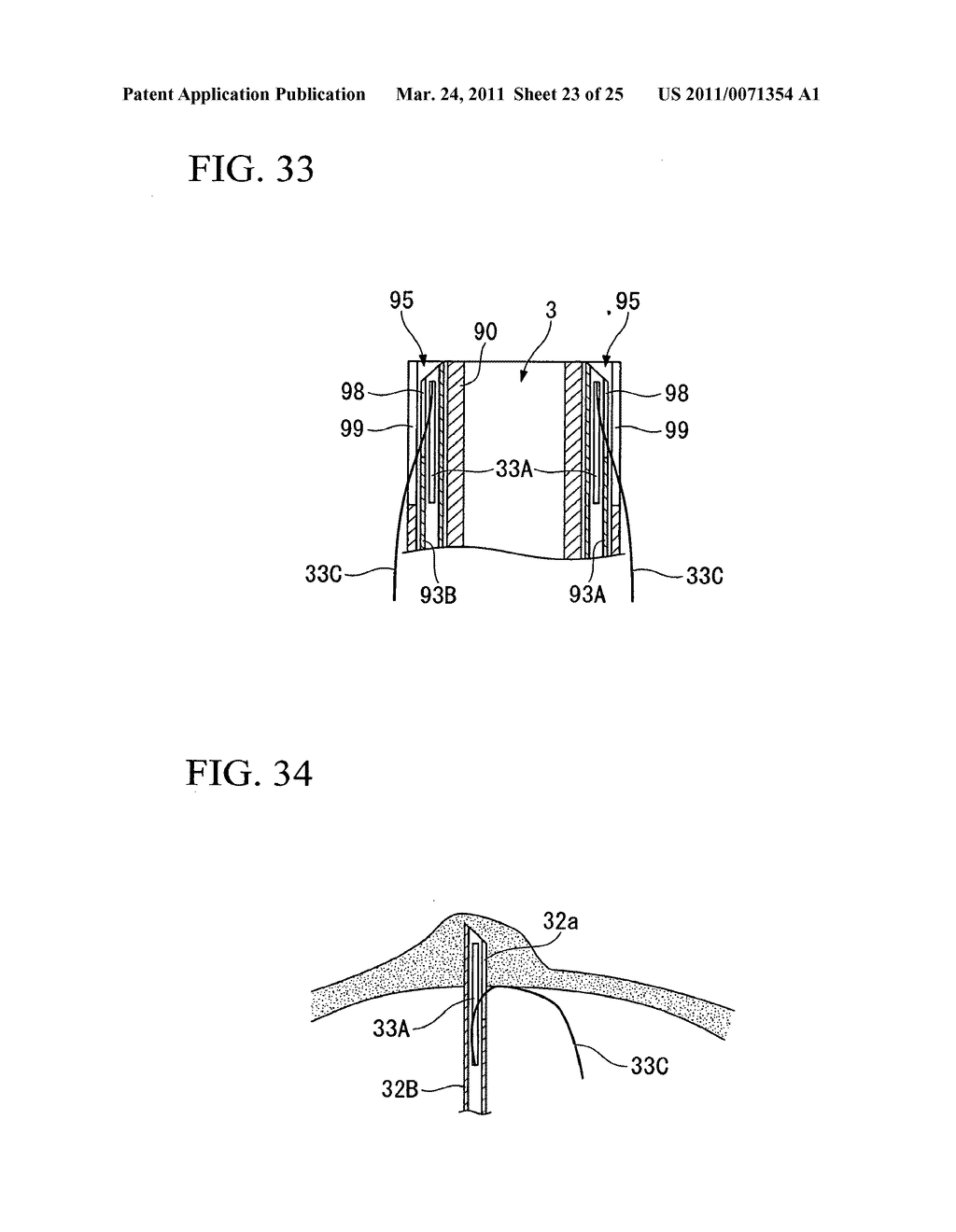 OVERTUBE AND MEDICAL PROCEDURE VIA NATURAL ORIFICE USING THE SAME - diagram, schematic, and image 24