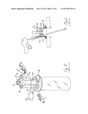 Instrument Access Device diagram and image