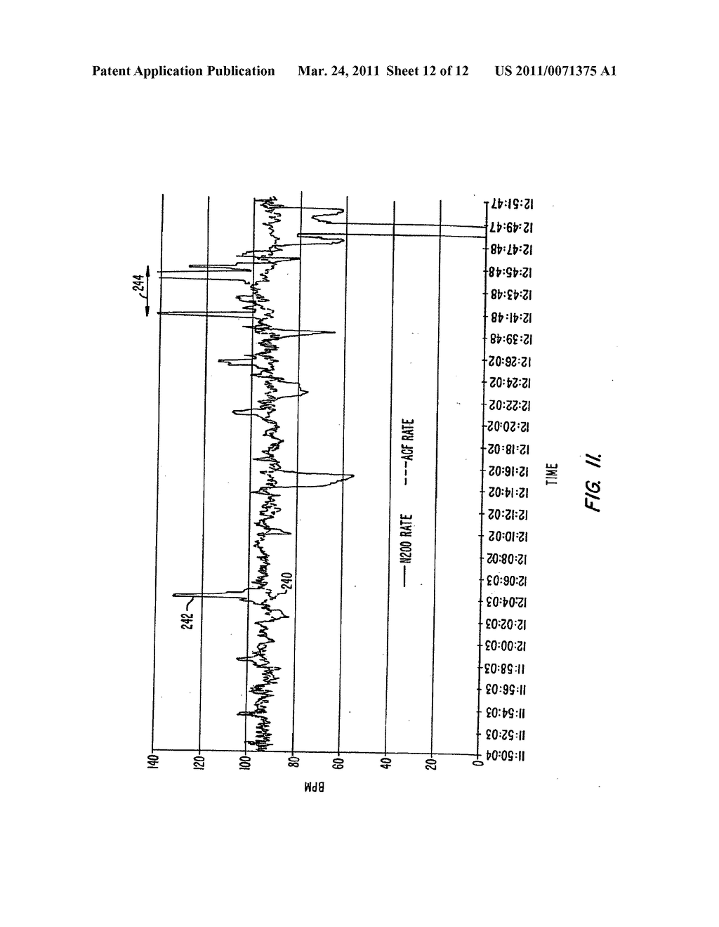 METHOD AND APPARATUS FOR ESTIMATING PHYSIOLOGICAL PARAMETERS USING MODEL-BASED ADAPTIVE FILTERING - diagram, schematic, and image 13