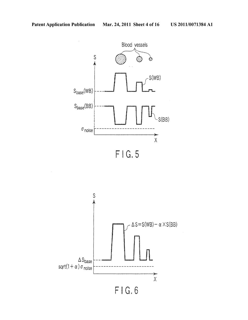 MAGNETIC RESONANCE IMAGING APPARATUS - diagram, schematic, and image 05