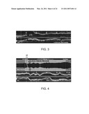 Lumen Morphology and Vascular Resistance Measurements Data Collection Systems, Apparatus and Methods diagram and image