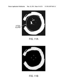 Lumen Morphology and Vascular Resistance Measurements Data Collection Systems, Apparatus and Methods diagram and image