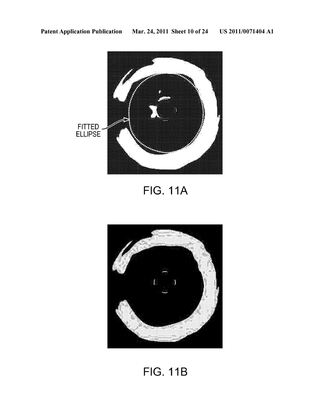 Lumen Morphology and Vascular Resistance Measurements Data Collection Systems, Apparatus and Methods - diagram, schematic, and image 11