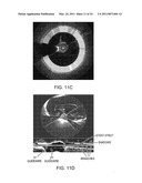 Lumen Morphology and Vascular Resistance Measurements Data Collection Systems, Apparatus and Methods diagram and image