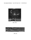 Lumen Morphology and Vascular Resistance Measurements Data Collection Systems, Apparatus and Methods diagram and image