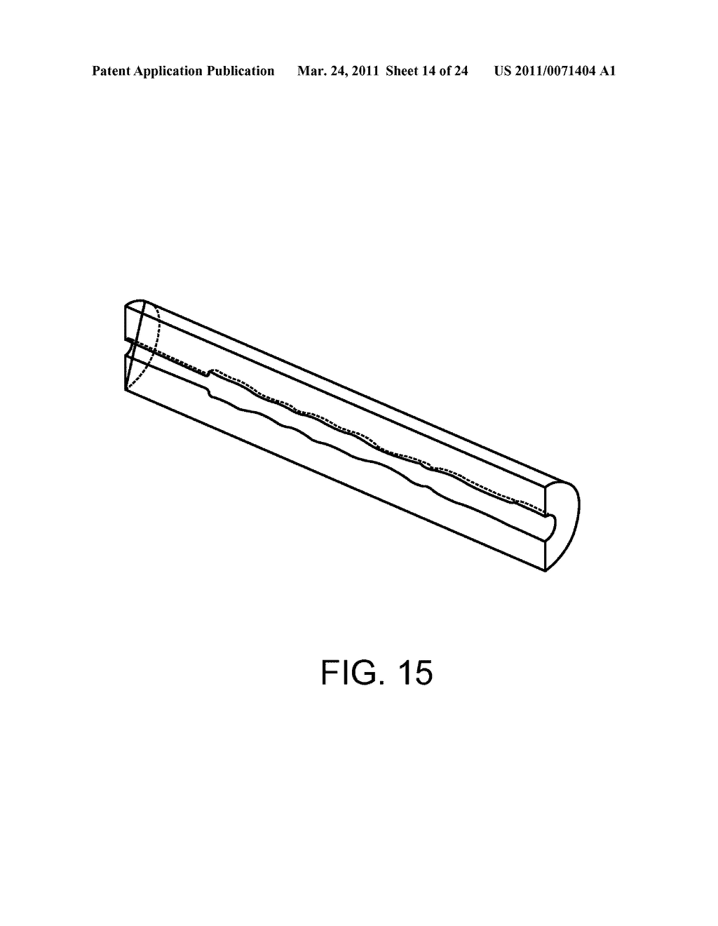 Lumen Morphology and Vascular Resistance Measurements Data Collection Systems, Apparatus and Methods - diagram, schematic, and image 15