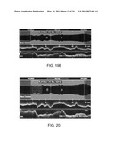 Lumen Morphology and Vascular Resistance Measurements Data Collection Systems, Apparatus and Methods diagram and image