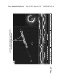 Lumen Morphology and Vascular Resistance Measurements Data Collection Systems, Apparatus and Methods diagram and image