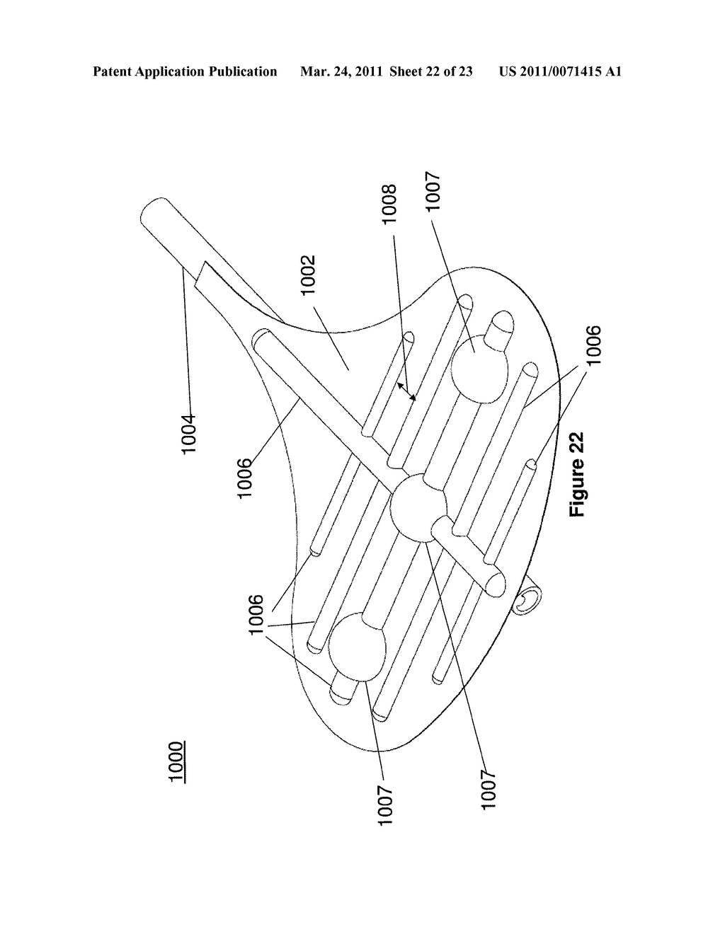 PLEURAL DRAINAGE SYSTEM AND METHOD OF USE - diagram, schematic, and image 23