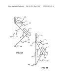 HYPEREXTENSION BRACE ASSEMBLY AND METHODS OF USE diagram and image