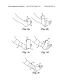 COMPRESSION BANDAGE SYSTEM diagram and image