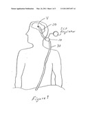 Method and apparatus for controlling intracranial pressure diagram and image