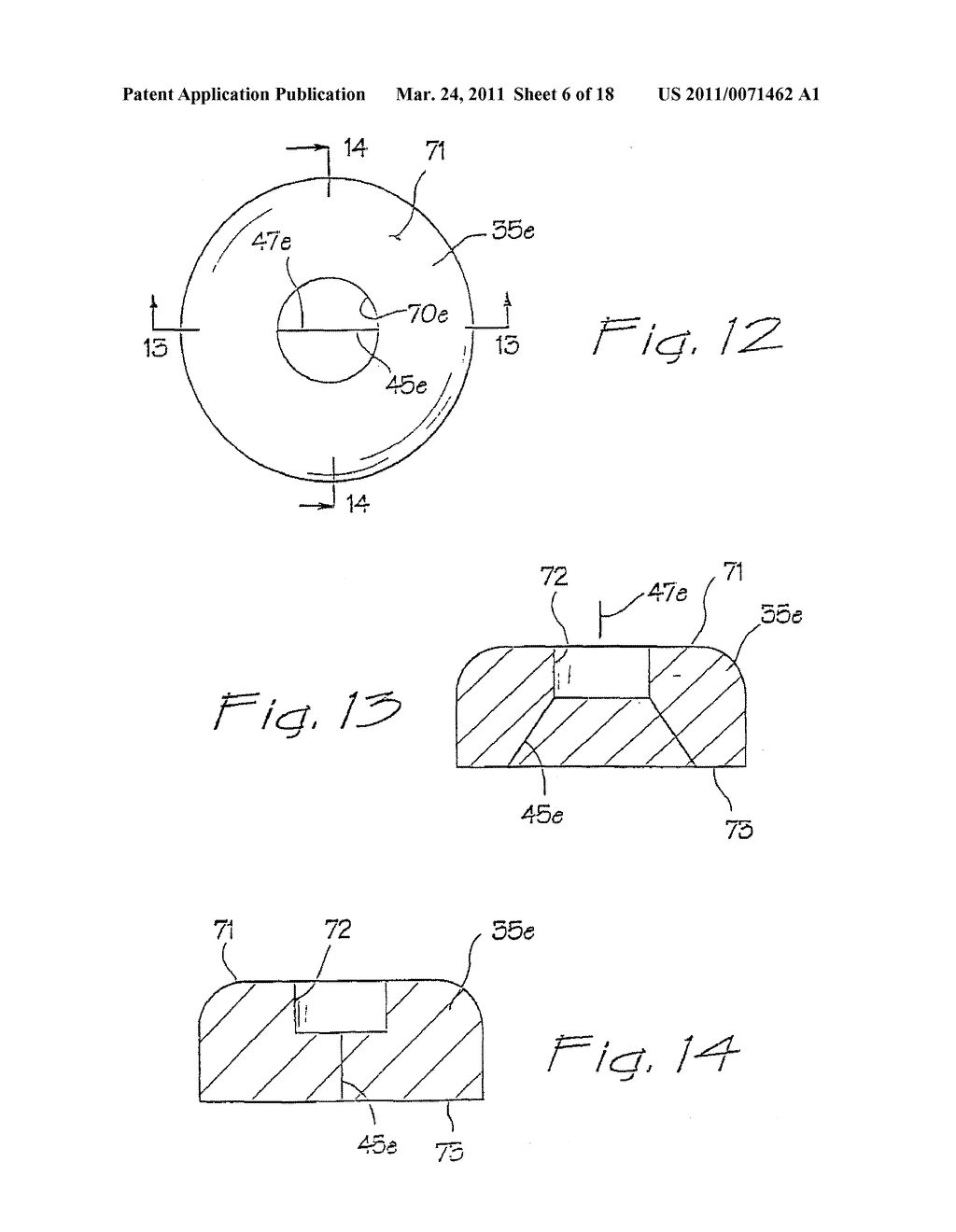 SURGICAL ACCESS APPARATUS AND METHOD - diagram, schematic, and image 07