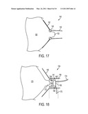 HIGHLY EFFICIENT BREASTPUMP AND SYSTEM FOR EXPRESSING BREASTMILK diagram and image