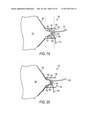 HIGHLY EFFICIENT BREASTPUMP AND SYSTEM FOR EXPRESSING BREASTMILK diagram and image