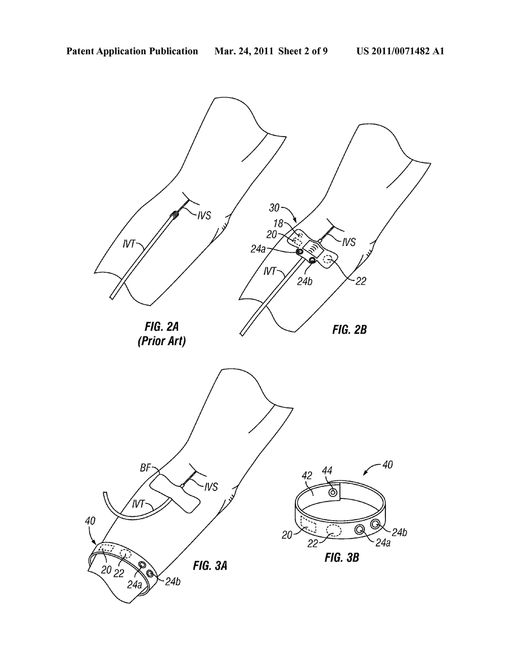 DEVICES AND METHODS FOR SIGNALING WHEN ACTION IS DUE IN RELATION TO A MEDICAL DEVICE - diagram, schematic, and image 03